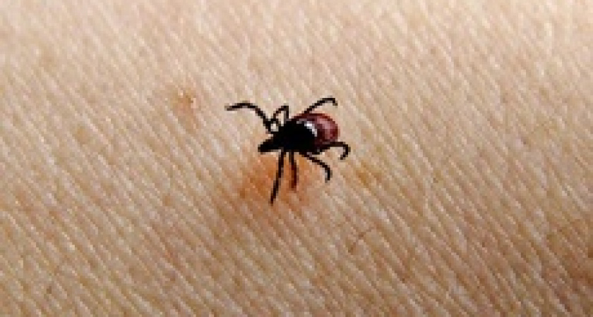 В Свердловской области от укуса клеща умер человек