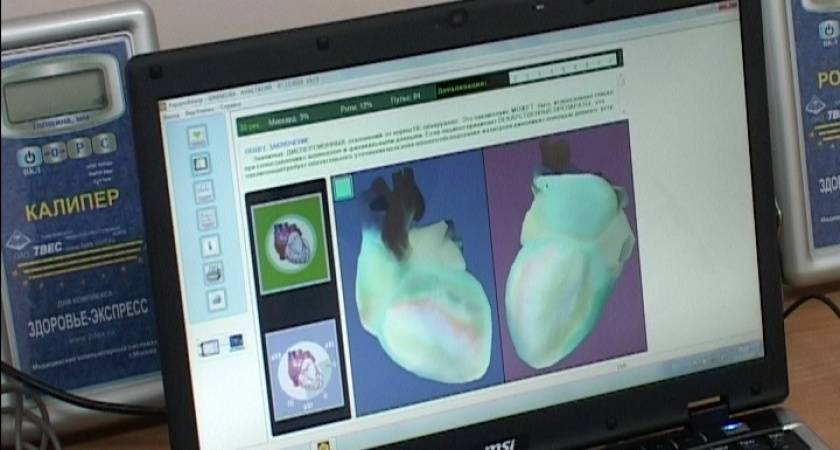 Кардиограмма - дистанционно
